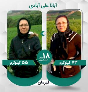 آبانا علی آبادی عزیز با کاهش وزن 18 کیلوگرم